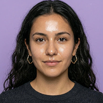 Piel Grasa