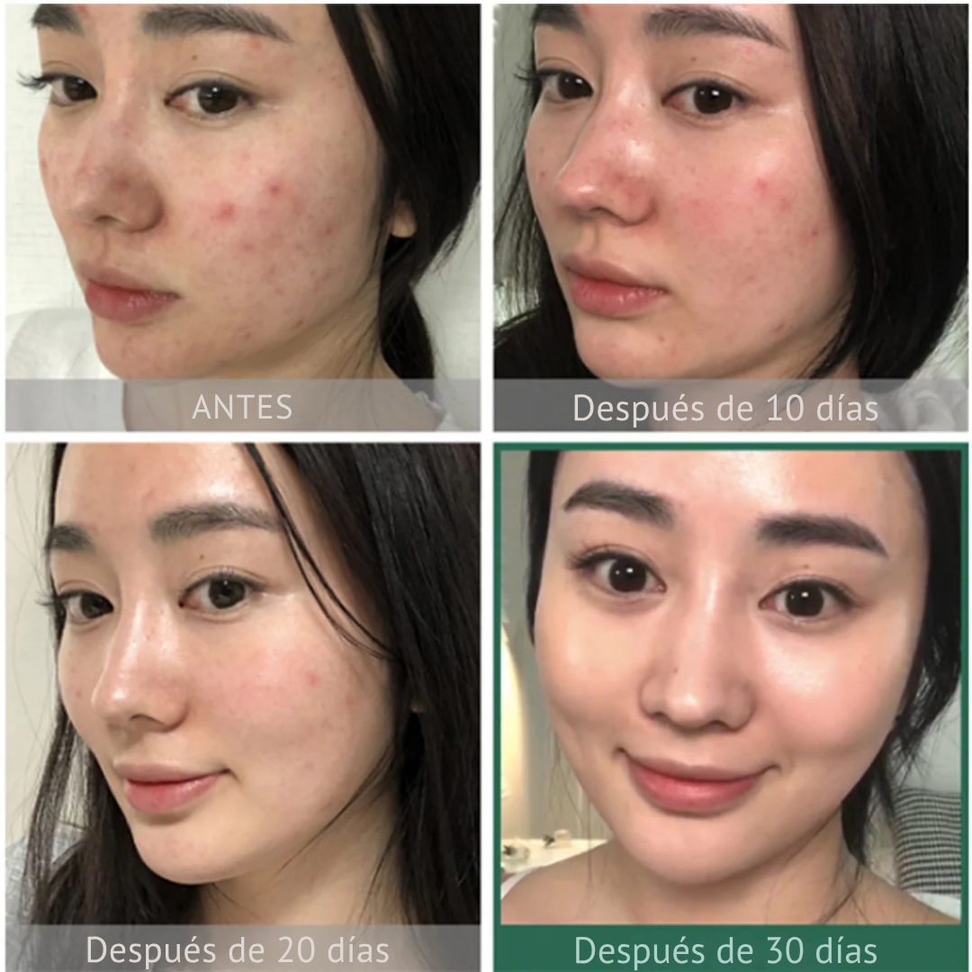 Some By Mi - Aha.Bha.Pha 30 Days Miracle Toner 210ml