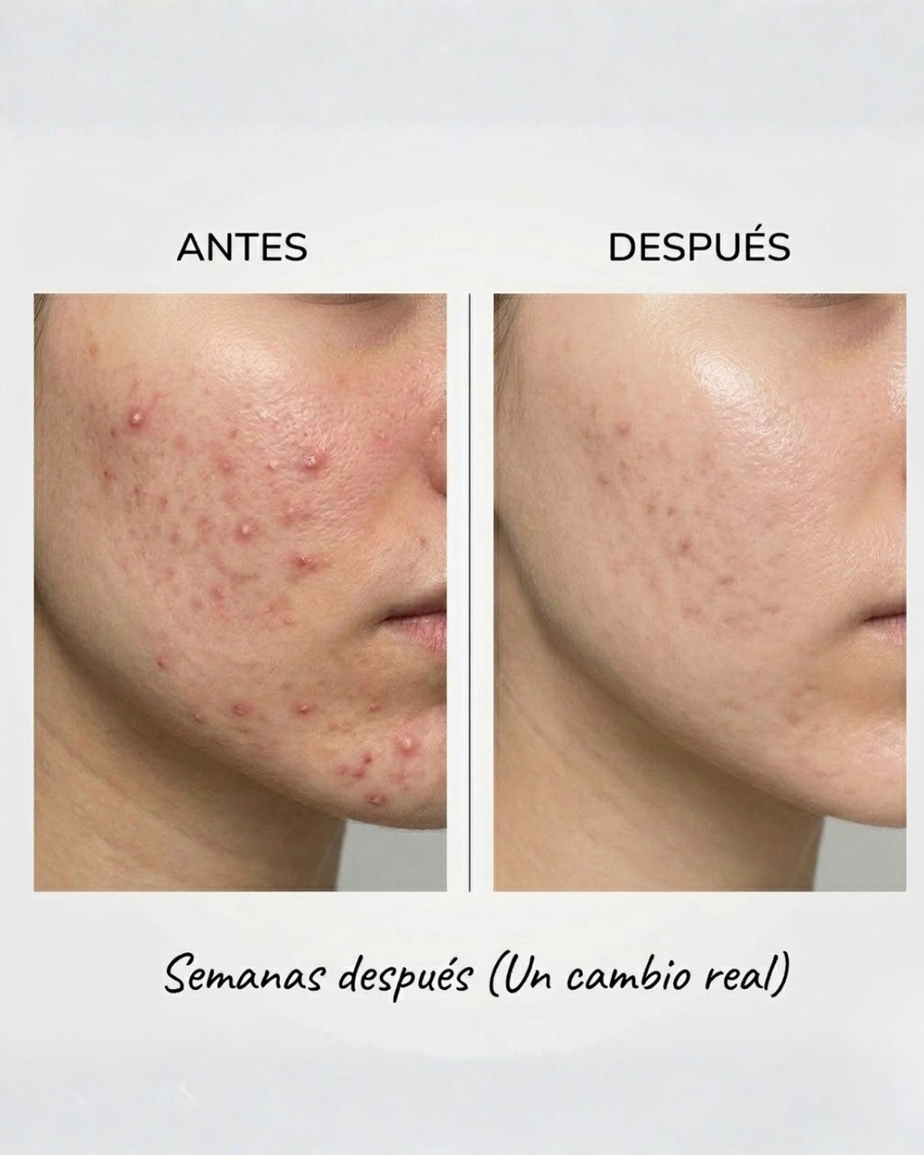 Dúo Antiacné & Manchas