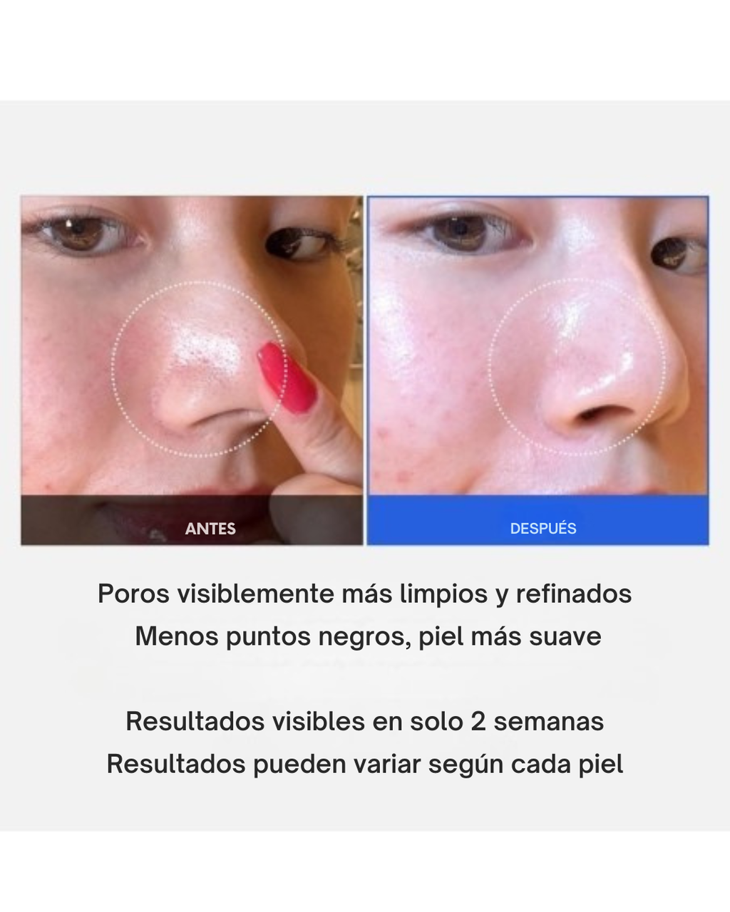 Zero Pore Pads poros limpios, piel libre de brillo- Medicube 70 pads