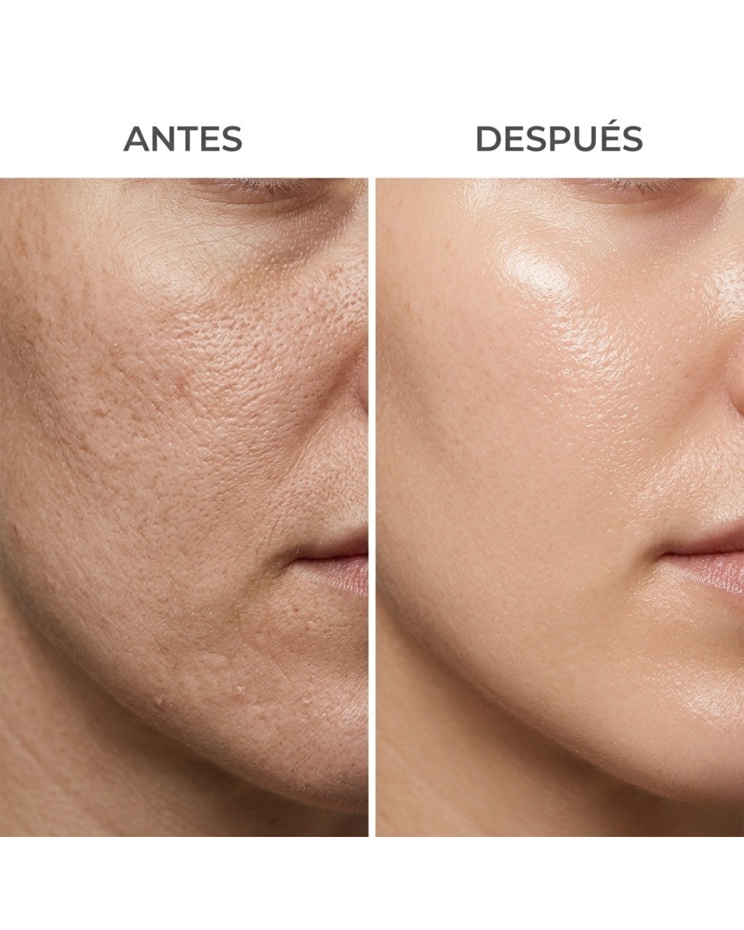 Microneedling en Casa + Reparación Intensiva